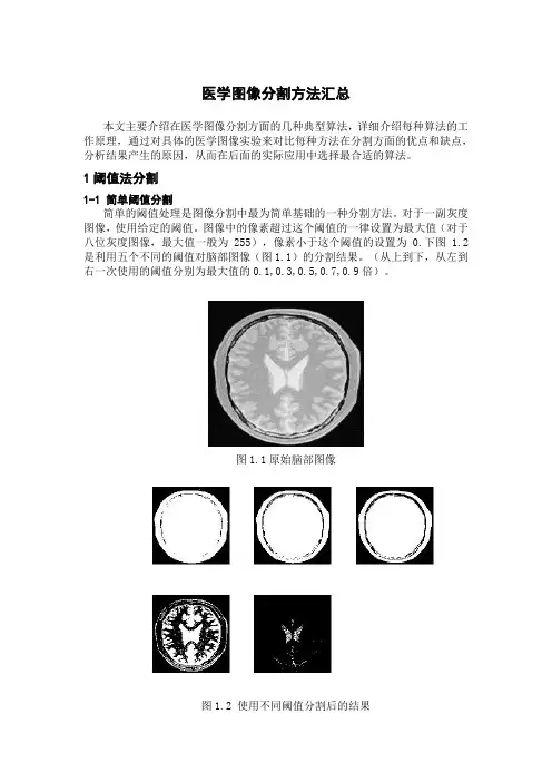 医学图像分割方法汇总.