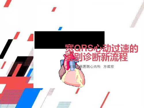 宽QRS波心动过速鉴别诊断