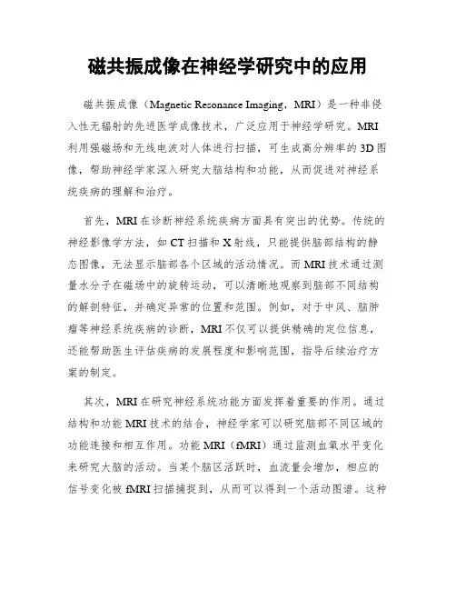 磁共振成像在神经学研究中的应用