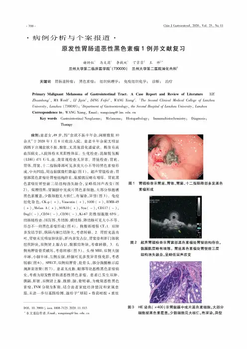 原发性胃肠道恶性黑色素瘤1例并文献复习