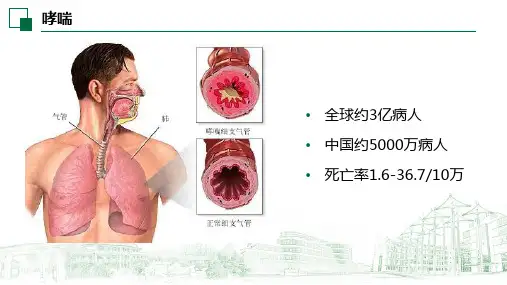 《呼吸系统疾病病人的护理》课件——呼气峰流速的测定和临床意义