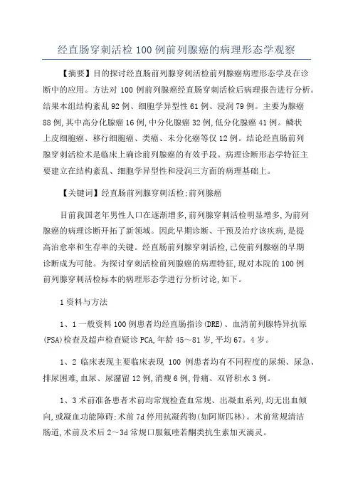 经直肠穿刺活检100例前列腺癌的病理形态学观察