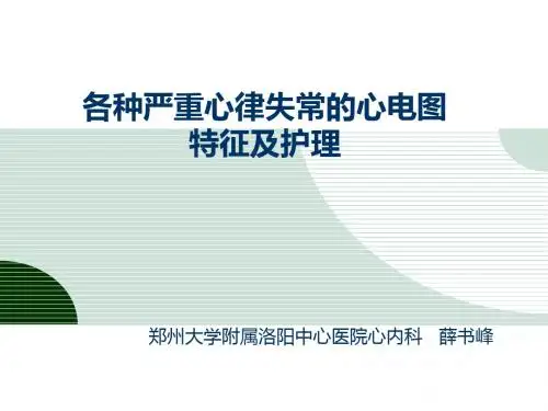 心律失常心电图特征及处理方式