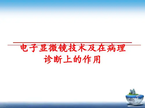 最新电子显微镜技术及在病理诊断上的作用PPT课件