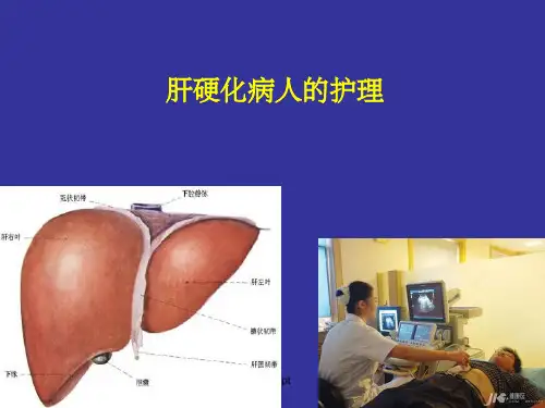 肝硬化病人的护理