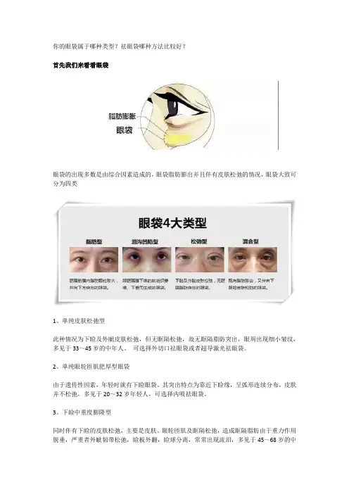 你的眼袋属于哪种类型？祛眼袋哪种方法比较好