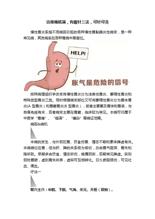 治胃痛痞满，有腹针三法，可针可灸