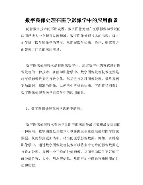 数字图像处理在医学影像学中的应用前景