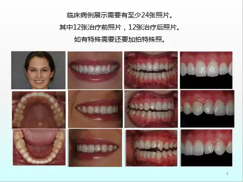 口腔摄影AACD标准医学课件