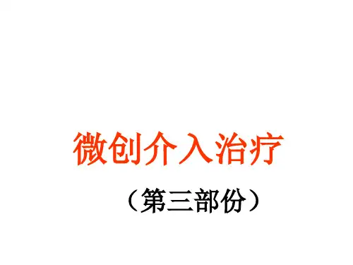 微创介入手术治疗C