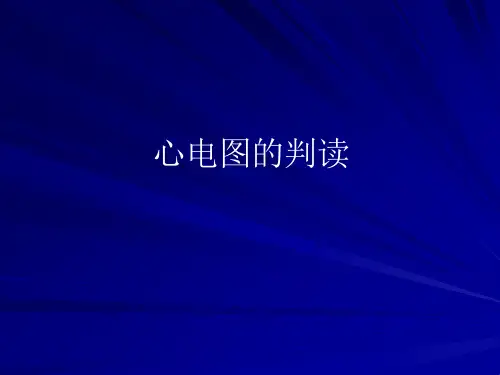 心电图ppt课件