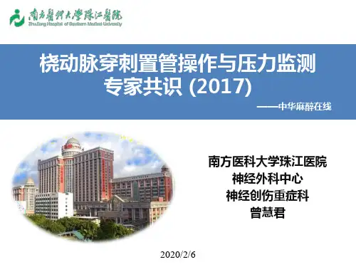桡动脉穿刺置管操作及压力监测专家共识