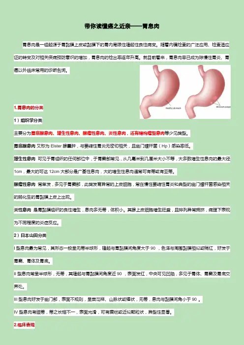 胃息肉 (1)