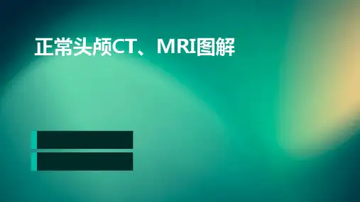 正常头颅CT、MRI图解