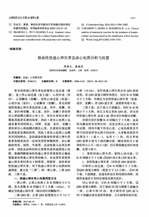致命性快速心率失常急诊心电图分析与处置
