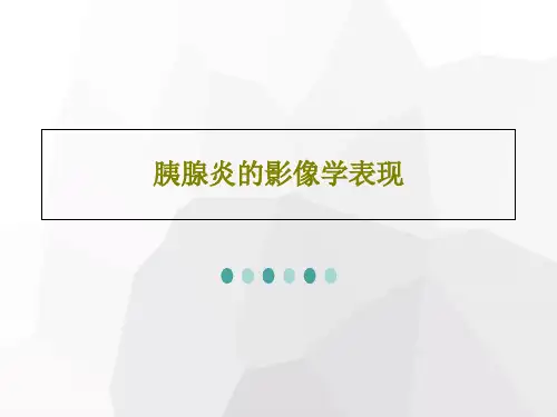 胰腺炎的影像学表现50页PPT