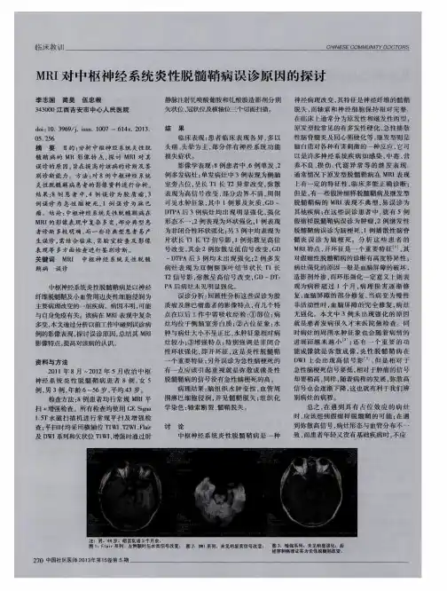 MRI对中枢神经系统炎性脱髓鞘病误诊原因的探讨