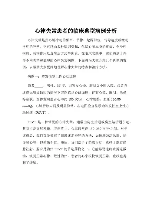 心律失常患者的临床典型病例分析