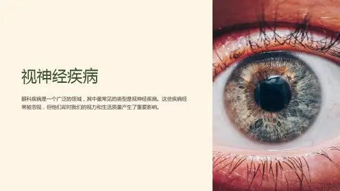 《视神经疾病》课件