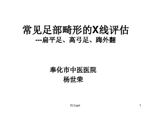 常见足部畸形疾病X线评估ppt课件