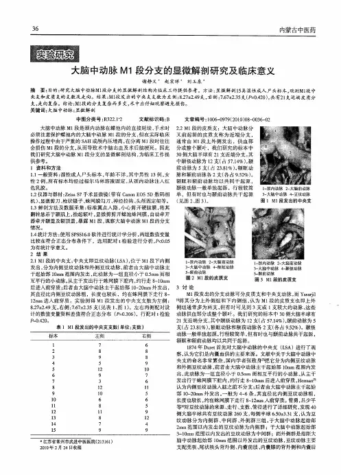 大脑中动脉M1段分支的显微解剖研究及临床意义