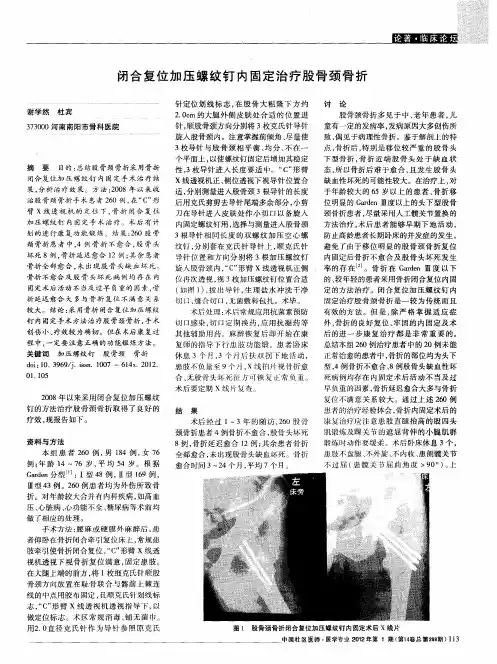 闭合复位加压螺纹钉内固定治疗股骨颈骨折