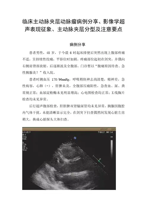 临床主动脉夹层动脉瘤病例分享、影像学超声表现征象、主动脉夹层分型及注意要点