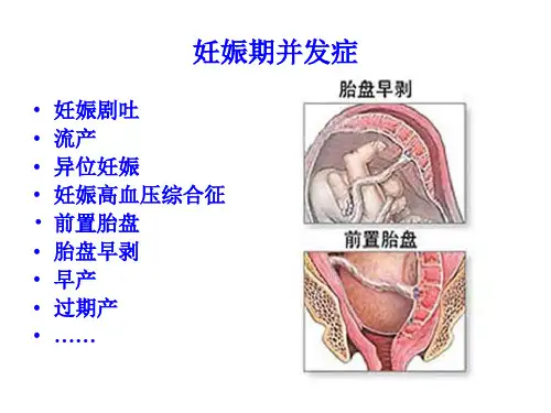 最新妊娠合并症并发症处理PPT课件