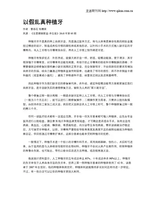以假乱真种植牙