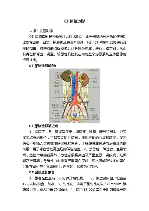 CT尿路造影