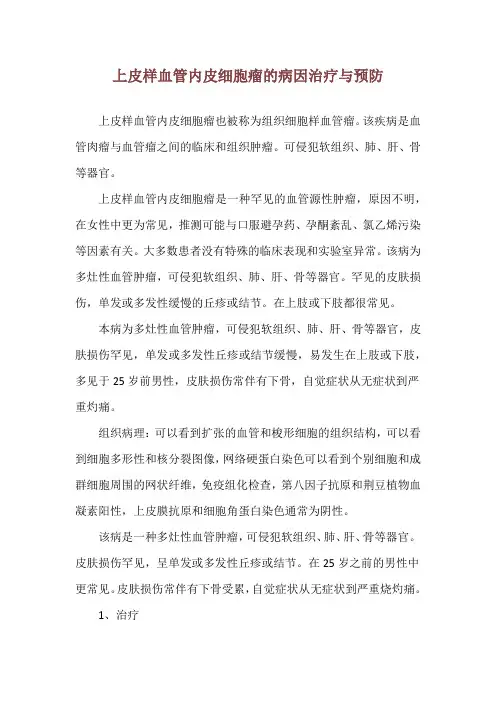 上皮样血管内皮细胞瘤的病因治疗与预防