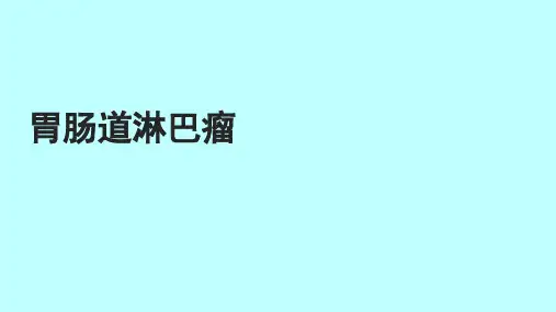 胃肠道淋巴瘤影像
