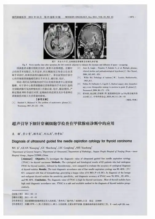 超声引导下细针穿刺细胞学检查在甲状腺癌诊断中的应用