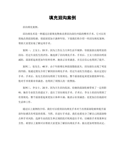 填充泪沟案例