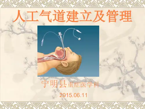 人工气道建立及管理概要ppt课件