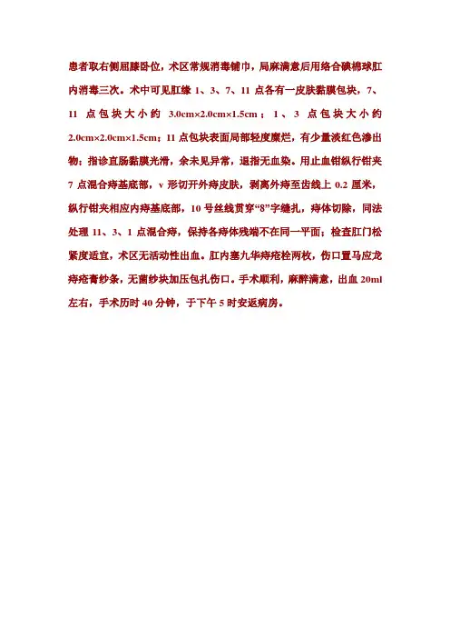 混合痔手术