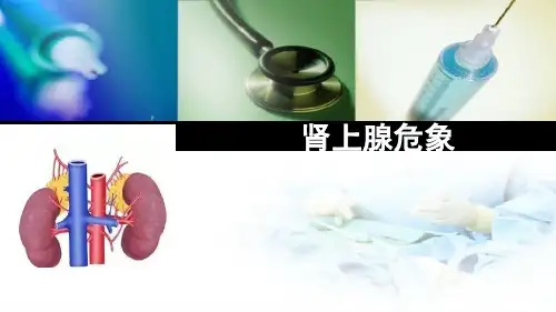 肾上腺危象ppt课件【22页】