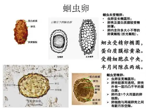 寄生虫学虫卵经典总结及图片-(yj)