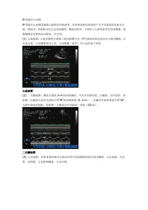 正常超声心动图