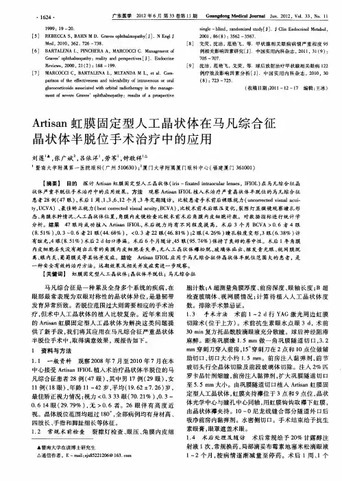 Artisan虹膜固定型人工晶状体在马凡综合征晶状体半脱位手术治疗中的应用