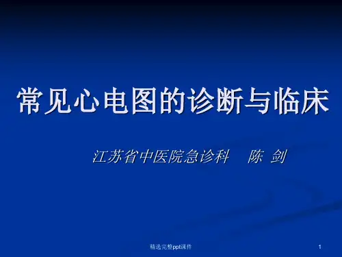 经典：常见心电图诊断与临床