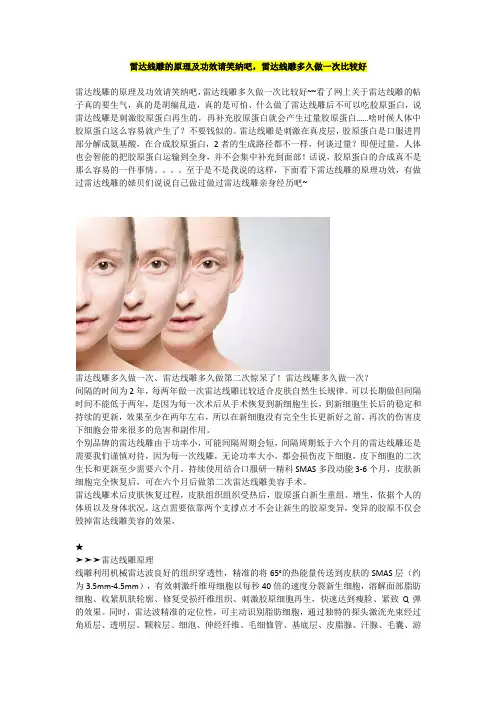 雷达线雕的原理及功效请笑纳吧,雷达线雕多久做一次比较好