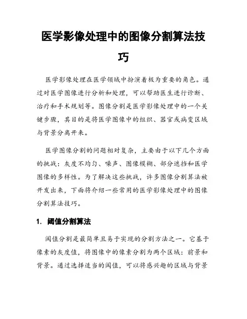 医学影像处理中的图像分割算法技巧