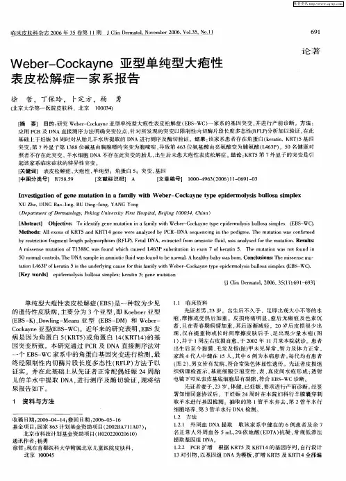 Weber-Cockayne亚型单纯型大疱性表皮松解症一家系报告