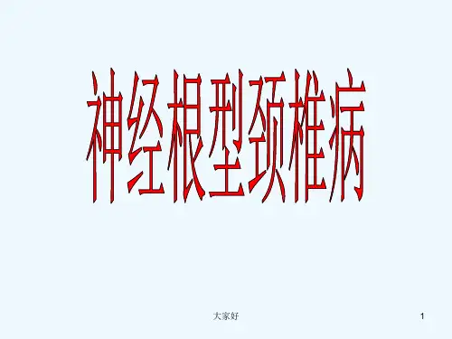 神经根型颈椎病 PPT【12页】