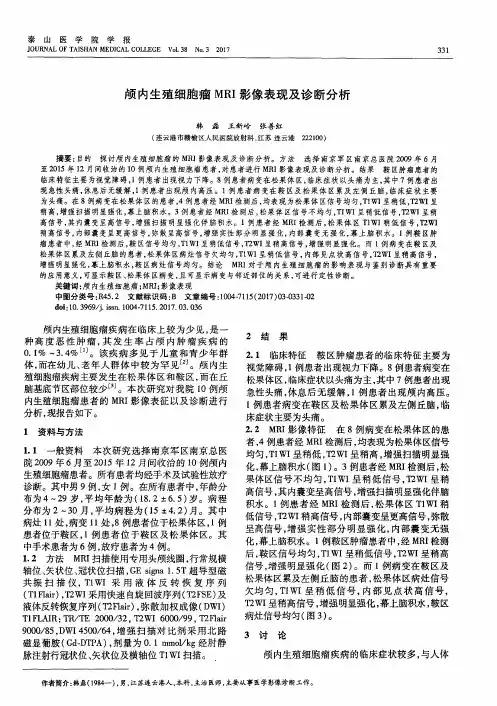 颅内生殖细胞瘤MRI影像表现及诊断分析