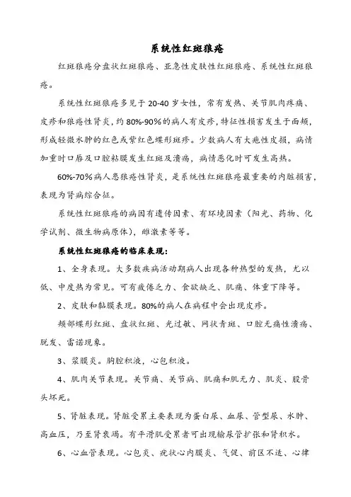 系统性红斑狼疮