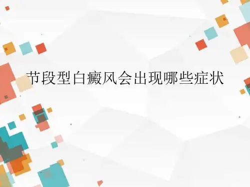 毛春光讲解：节段型白癜风会出现哪些症状