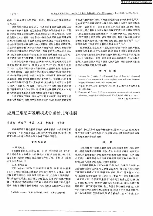 应用三维超声透明模式诊断胎儿脊柱裂