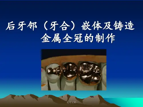 铸造金属全冠的制作